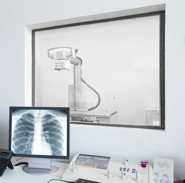 Radiografia della colonna vertebrale il metodo principale per diagnosticare l'osteocondrosi