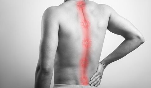 Diverse lesioni alla schiena causano dolori nella regione lombare