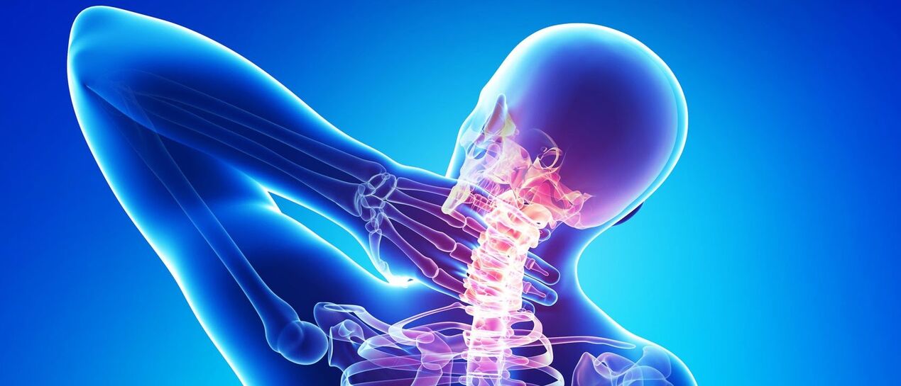 L'osteocondosi cervicale è un processo patologico nell'area della colonna vertebrale