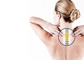 osteocondrosi della colonna vertebrale toracica
