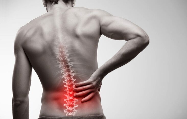 dolore lombare dovuto all'osteocondrosi